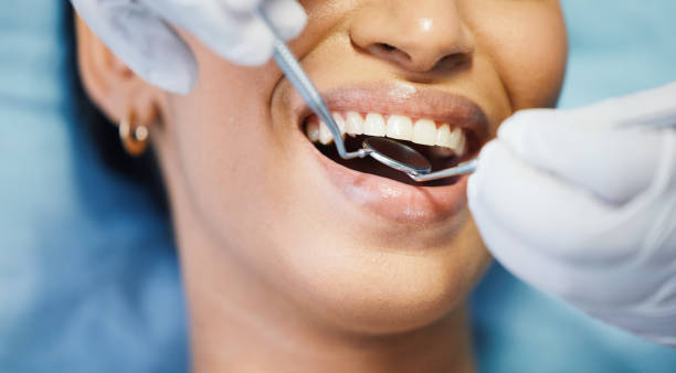 Best Root Canal Emergency Dentist  in Cornish, ME